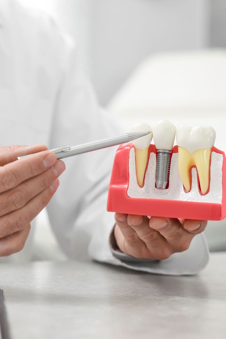 Why restorative dentistry matters