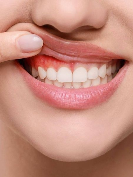 Why periodontal care matters