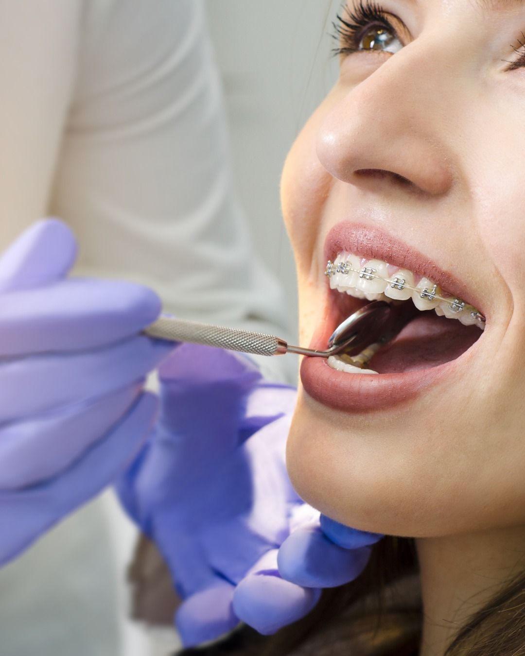 Restorative Dentistry at NY Elite Dental